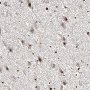 Anti-CPN2 antibody produced in rabbit 