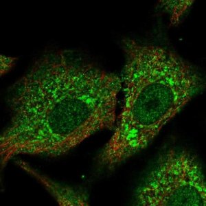 Anti-CPNE2 antibody produced in rabbit 