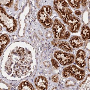 Anti-CPSF4L antibody produced in rabbit 