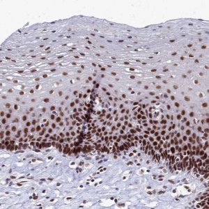 Anti-CPSF7 antibody produced in rabbit HPA041094-100UL