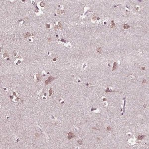 Anti-CPT1C antibody produced in rabbit 