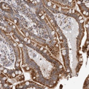 Anti-CPT2 antibody produced in rabbit 