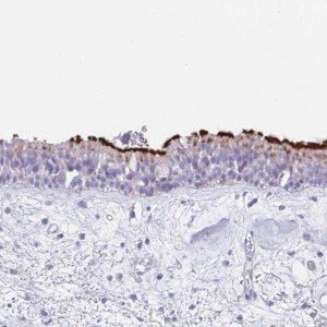 Anti-CPXM2 antibody produced in rabbit 