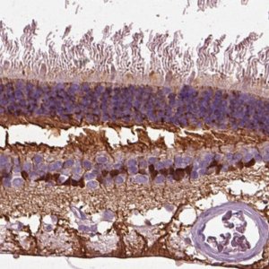Anti-CRABP1 antibody produced in rabbit 