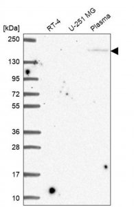 Anti-CRB1 antibody produced in rabbit 