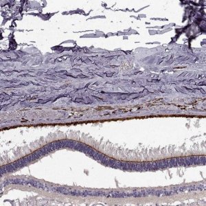 Anti-CRB2 antibody produced in rabbit 