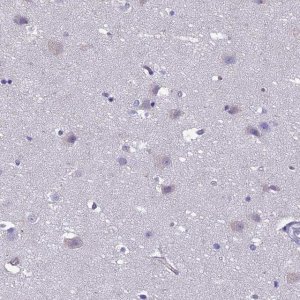 Anti-CRB2 antibody produced in rabbit 