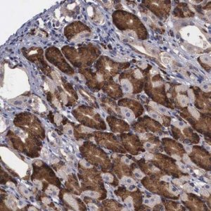 Anti-CRELD2 antibody produced in rabbit 