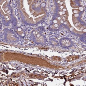 Anti-CRHBP antibody produced in rabbit 