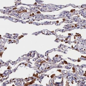 Anti-CRIP1 antibody produced in rabbit 