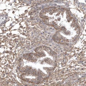 Anti-CRIP3 antibody produced in rabbit HPA036198-100UL