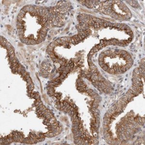 Anti-CRISPLD1 antibody produced in rabbit 