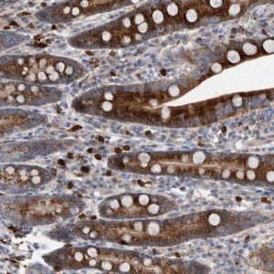 Anti-CRISPLD2 antibody produced in rabbit 