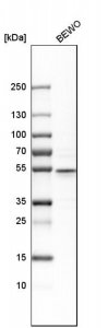 Anti-CRISPLD2 antibody produced in rabbit 