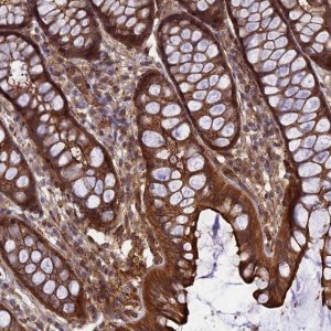 Anti-CRTAP antibody produced in rabbit 