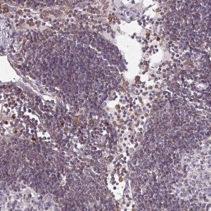 Anti-CSF3R antibody produced in rabbit 