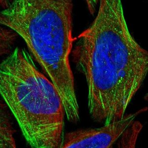 Anti-CSGALNACT1 antibody produced in rabbit 