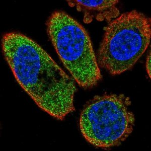 Anti-CSNK1A1 antibody produced in rabbit 