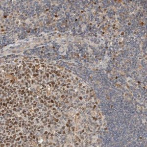 Anti-CSNK1G3 antibody produced in rabbit 