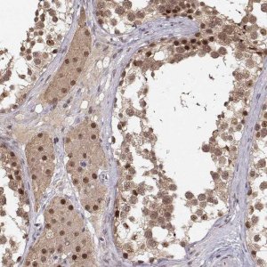 Anti-CSNK2A1 antibody produced in rabbit 