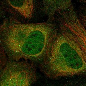 Anti-CSNK2A2 antibody produced in rabbit 