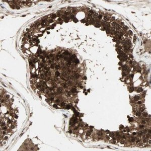 Anti-CSNK2B antibody produced in rabbit 
