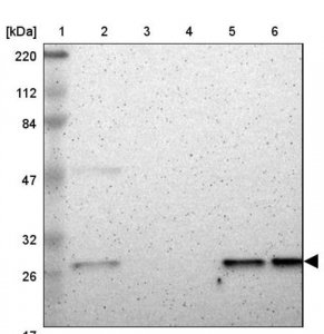 Anti-CSNK2B antibody produced in rabbit 