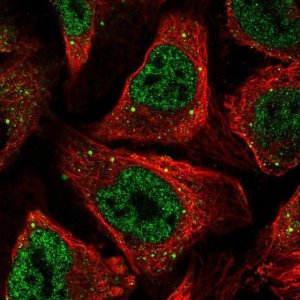 Anti-CSRNP1 antibody produced in rabbit 