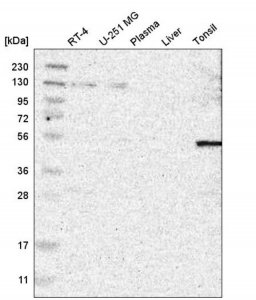 Anti-CSRNP2 antibody produced in rabbit 