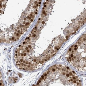 Anti-CT45A1 antibody produced in rabbit 