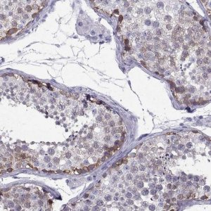 Anti-CT47A1 antibody produced in rabbit 