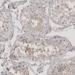 Anti-CT83 antibody produced in rabbit 