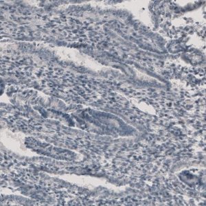 Anti-CT83 antibody produced in rabbit 