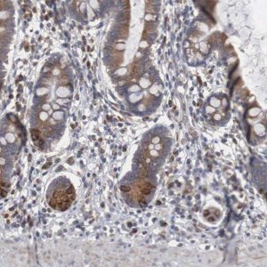 Anti-CTAGE5 antibody produced in rabbit 