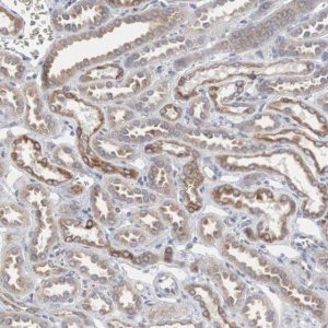 Anti-CTAGE5 antibody produced in rabbit 