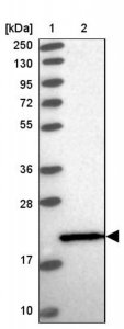 Anti-CTBP2 antibody produced in rabbit HPA044971-100UL