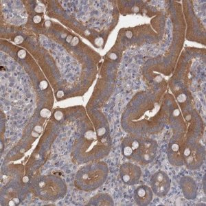 Anti-CTBS antibody produced in rabbit 
