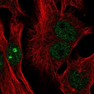 Anti-CTC-534A2.2 antibody produced in rabbit 