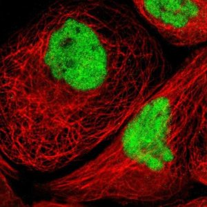 Anti-CTCF antibody produced in rabbit 