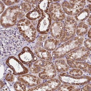 Anti-CTD-3088G3.8 antibody produced in rabbit 