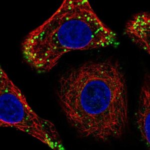 Anti-CTDNEP1 antibody produced in rabbit 