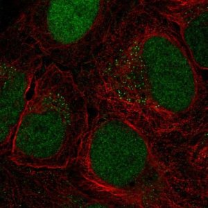 Anti-CTDP1 antibody produced in rabbit 