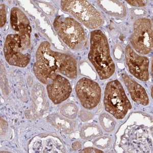 Anti-CTDSP2 antibody produced in rabbit 
