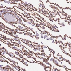 Anti-CTDSPL antibody produced in rabbit 