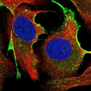 Anti-CTDSPL antibody produced in rabbit 