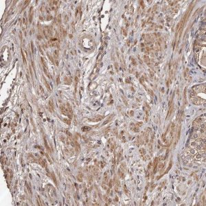 Anti-CTGF antibody produced in rabbit 