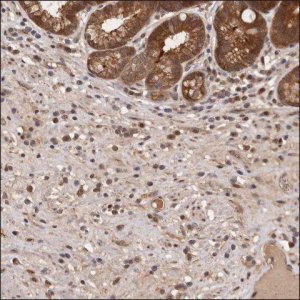Anti-CTGF antibody produced in rabbit HPA031074-100UL