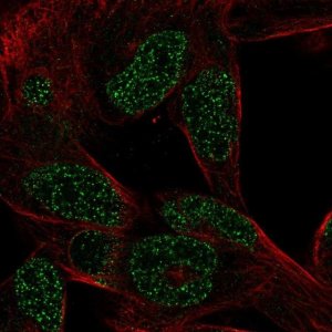 Anti-CTHRC1 antibody produced in rabbit 