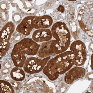 Anti-CTIF antibody produced in rabbit 