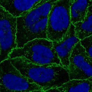 Anti-CTNNA1 antibody produced in rabbit HPA063535-100UL